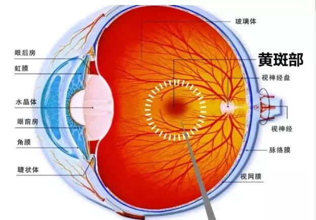 眼底黃斑出血最新的治療方法,眼底黃斑出血最新治療方法的研究與進(jìn)展